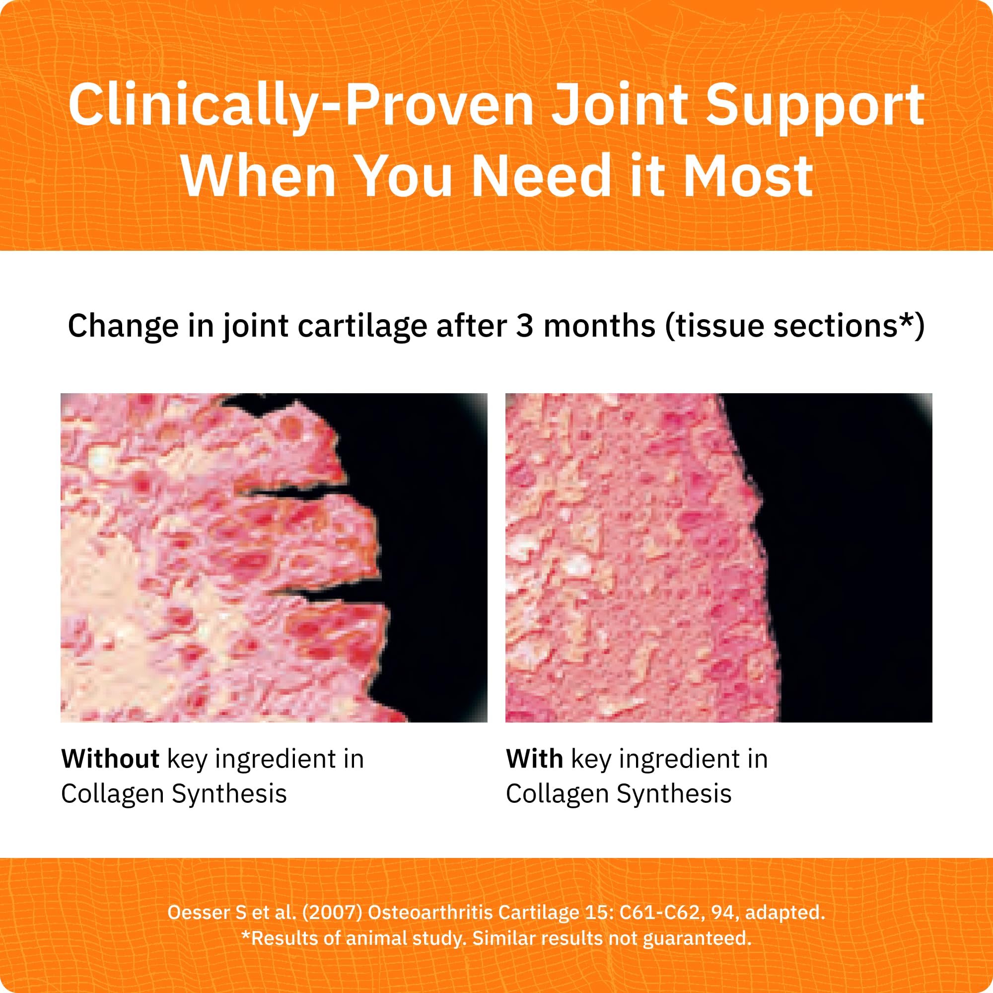 SaltWrap Collagen Synthesis Peptides for Joints, Tendon & Ligament Recovery | Cartilage repair collagen powder supplement. Features patented Tendoforte and Fortigel. Unflavored, NSF Certified bone health