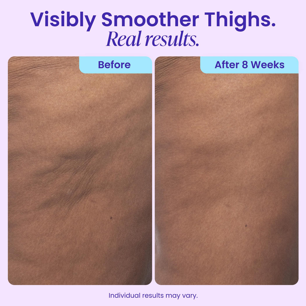 goPure Firming Butt & Thigh Cream - Skin Tightening Cream for Body with 8% MaxLift3 Complex - Visibly Smooths Stretch Marks - Cellulite Cream & Crepe Solution - Hydrating Barrier - Clinically Tested