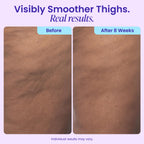 goPure Firming Butt & Thigh Cream - Skin Tightening Cream for Body with 8% MaxLift3 Complex - Visibly Smooths Stretch Marks - Cellulite Cream & Crepe Solution - Hydrating Barrier - Clinically Tested