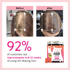 Bears with Benefits Biotin 5,000 mcg Hair Growth Gummies | Complete beauty formula with Vitamins C & E, Zinc and Iodine to support healthy hair, glowing skin and stronger nails.