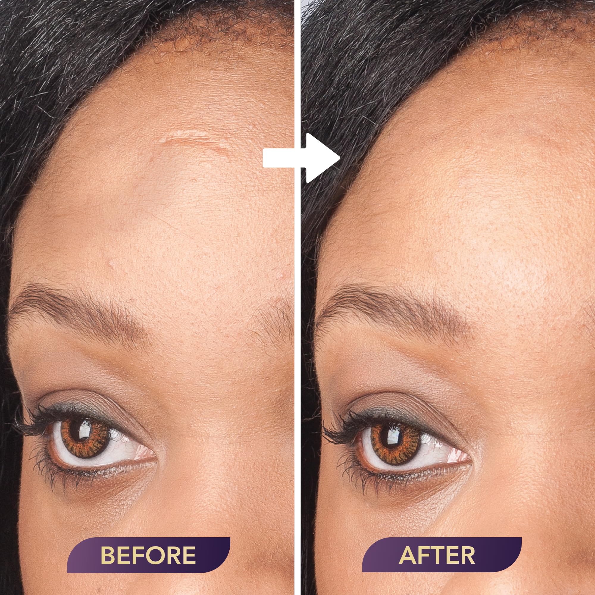 Buy now Dermaflage Extended Wear Primer, for use with Dermaflage Topical Filler at indiglob india