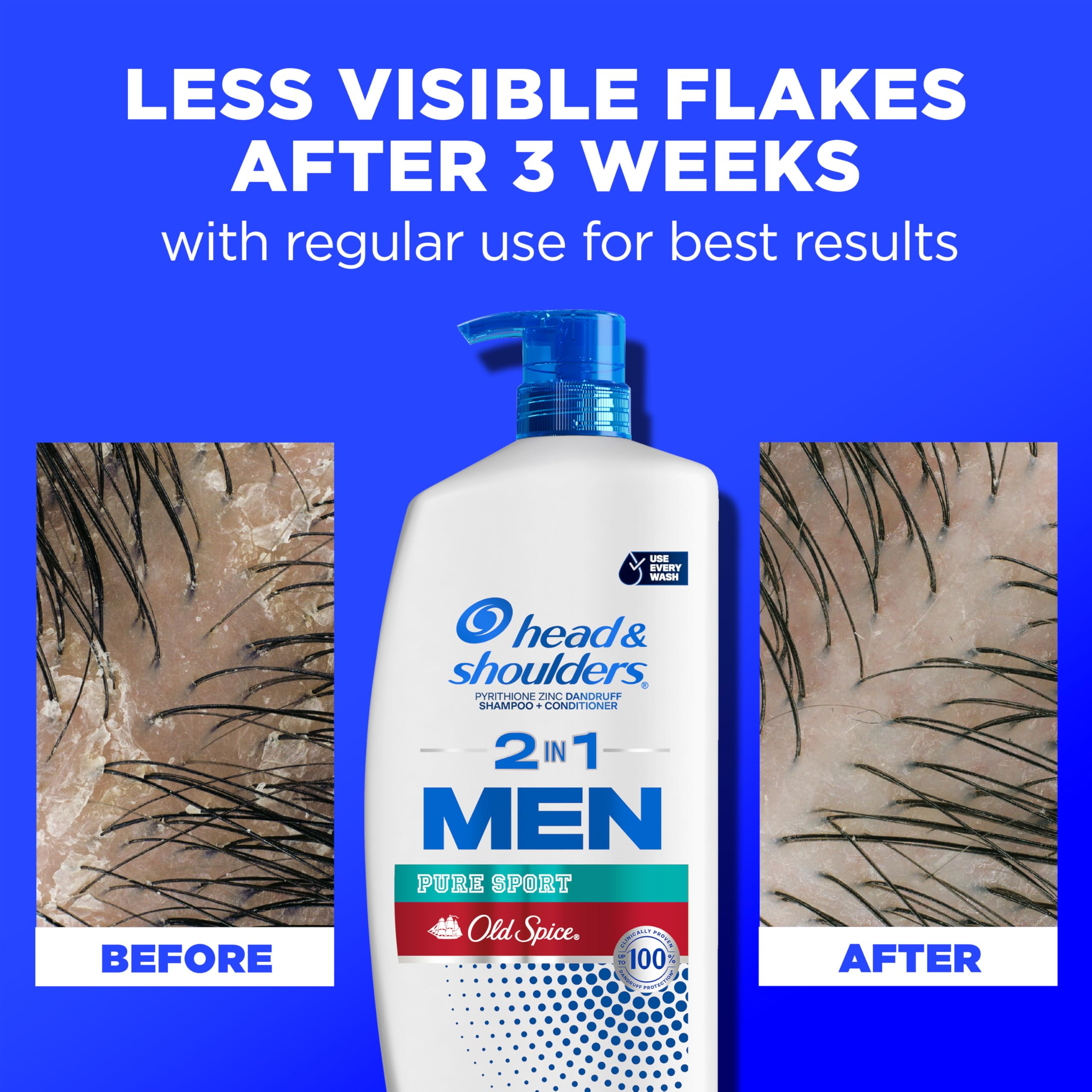 Head & Shoulders Old Spice Pure Sport 2-in-1 Anti-Dandruff Shampoo and Conditioner Twin Pack, 72-Hour Protection, 31.4 fl oz Each