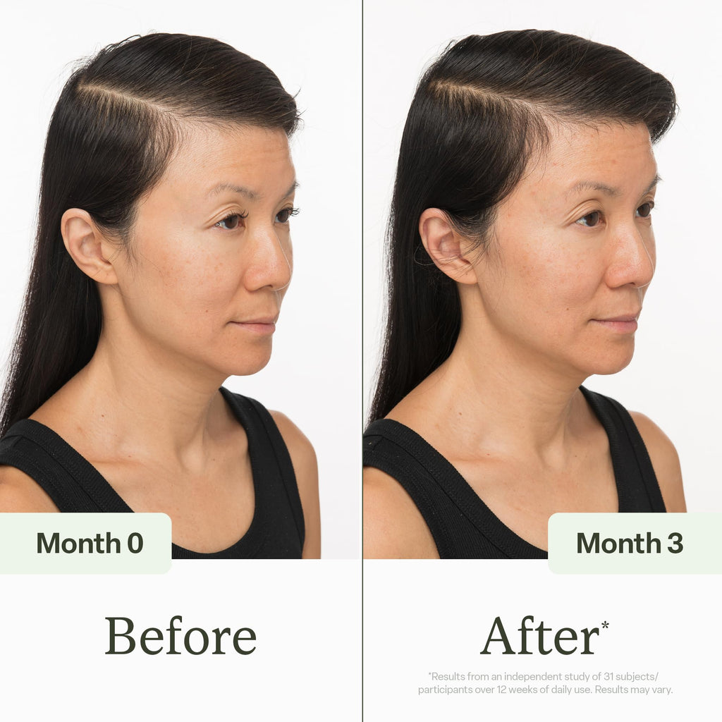 Divi Scalp Serum | To Promote Fuller-Looking Hair with Peptides | 30ml | Multi-Peptide Complex, Caffeine, Rosemary Oil, Vegan, Non-Greasy, Thinning Hair, Fuller-Looking Hair, Scalp Serum, 30ml