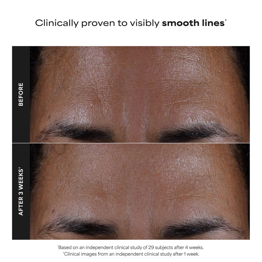 Paula's Choice SKIN PERFECTING 2% BHA Liquid Exfoliant | Gentle Salicylic Acid Facial Exfoliator for Blackheads, Enlarged Pores, Wrinkles & Fine Lines