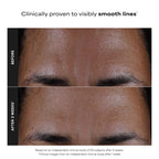 Paula's Choice SKIN PERFECTING 2% BHA Liquid Exfoliant | Gentle Salicylic Acid Facial Exfoliator for Blackheads, Enlarged Pores, Wrinkles & Fine Lines