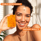 5 Pcs 80g Turmeric Kojic Acid Soap Bars with 2 Foaming Mesh Nets | Infused with Retinol, Collagen, Vitamin E & Shea Butter, SLS-Free, Gentle for Face, Body & Underarms, Fits Oily & Dry Skin