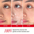 First Aid Beauty Ultra Gentle Cream-to-Foam Facial Cleanser,Makeup Removing Face Wash with Colloidal Oatmeal & Glycerin, Sensitive & Acne-Prone Skin