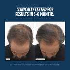 Nutrafol Men 50+ Hair Growth Supplements, Age 50+, 1-Month Bottle | #1 Dermatologist-Recommended Hair Growth Supplement Brand, Clinically Tested for Visibly Thicker Hair and Scalp Coverage
