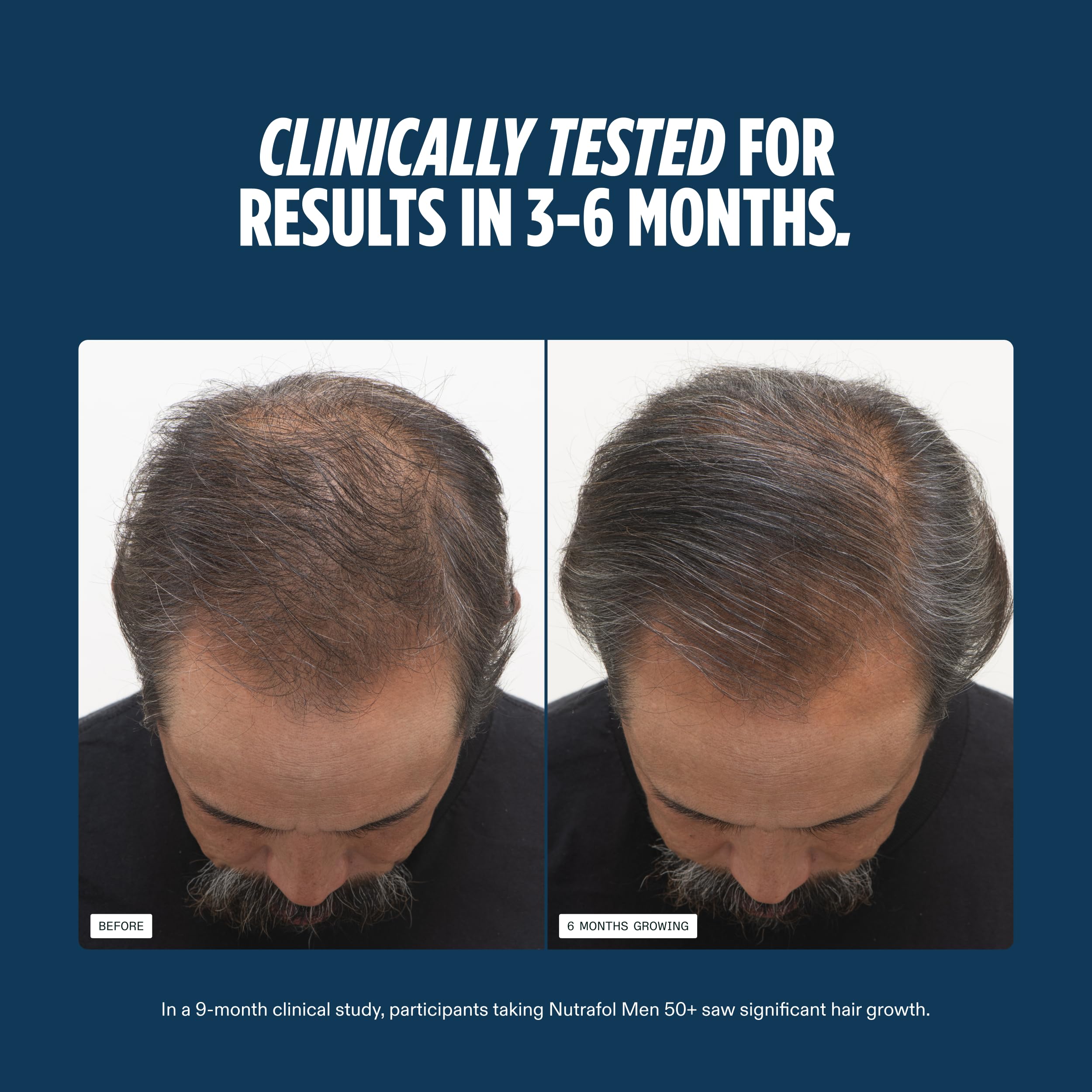 Nutrafol Men 50+ Hair Growth Supplements, Age 50+, 1-Month Bottle | #1 Dermatologist-Recommended Hair Growth Supplement Brand, Clinically Tested for Visibly Thicker Hair and Scalp Coverage