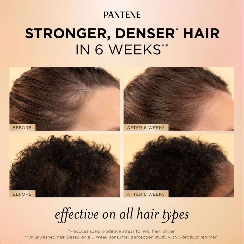 Pantene Abundant & Strong 3-Piece Regimen with B5 Complex + Niacinamide, Shampoo (13.5 oz), Conditioner (8 oz), Serum (2 oz) for Hair Loss, Thinning, Anti-Breakage, Volume - Grows Healthier