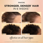 Pantene Abundant & Strong 3-Piece Regimen with B5 Complex + Niacinamide, Shampoo (13.5 oz), Conditioner (8 oz), Serum (2 oz) for Hair Loss, Thinning, Anti-Breakage, Volume - Grows Healthier
