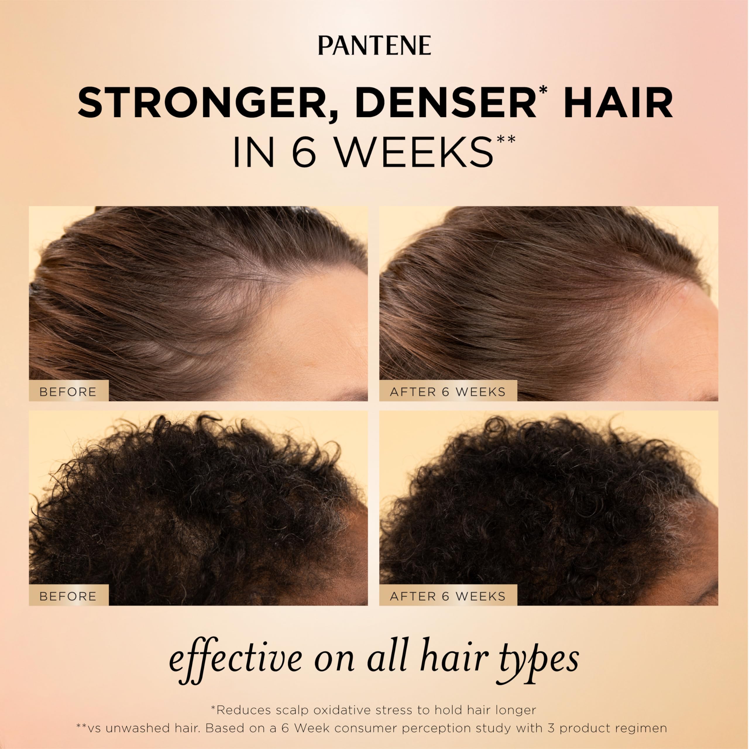 Pantene Abundant & Strong 3-Piece Regimen with B5 Complex + Niacinamide, Shampoo (13.5 oz), Conditioner (8 oz), Serum (2 oz) for Hair Loss, Thinning, Anti-Breakage, Volume - Grows Healthier