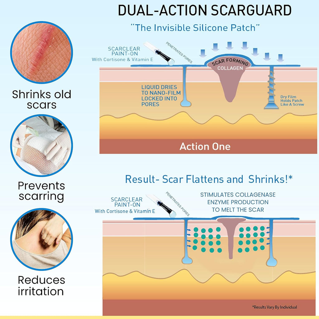 Buy now Scarguard - Invisible Brush-On Silicone Sheet with Vitamin E - Scar Removal for Keloids, Burn Scars, Surgery Scars, Stitches, Cuts - No Ugly Scar Sheets, Cream or Messy Scar Gel Needed at indiglob india