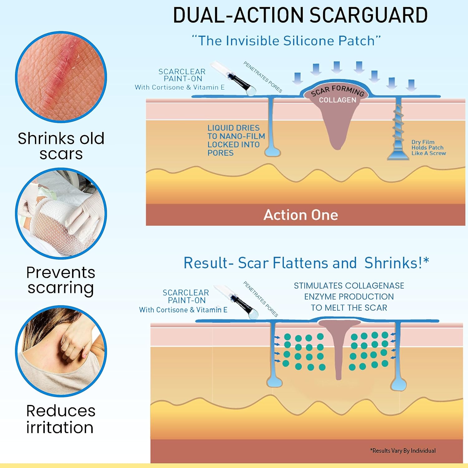 Buy now Scarguard - Invisible Brush-On Silicone Sheet with Vitamin E - Scar Removal for Keloids, Burn Scars, Surgery Scars, Stitches, Cuts - No Ugly Scar Sheets, Cream or Messy Scar Gel Needed at indiglob india