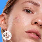 Buy now AVARELLE Acne Cover Patches, Eligible Hydrocolloid Pimple Patches for Face with Tea Tree Oil, Korean Skincare Zit Patches for Face | HSA Store Eligible Items | Vegan, Cruelty-free at indiglob india