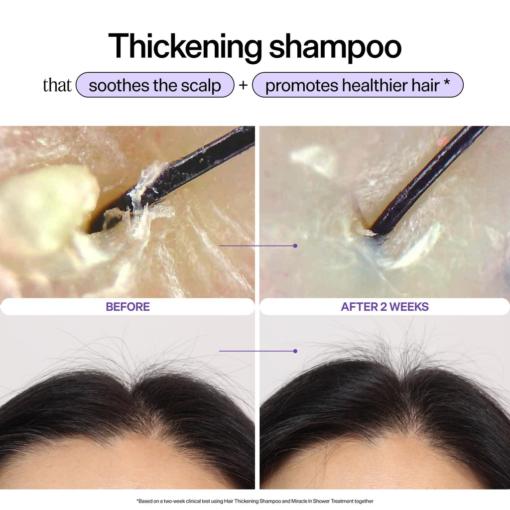 Dr. Groot Hair Thickening Shampoo, Korean Hair Care with Biotin, Rosemary Oil to Help Volumize Thinning, Damaged Hair, Hydrate Hair and Scalp, Biotin Shampoo, Scalp Revitalizing Solution