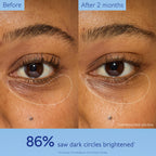 Caudalie Vinoperfect Dark Circle Brightening Caffeine Eye Cream - 15 mL