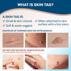 Claritag Advanced Skin Tag Remover, FDA-Cleared Freeze-Off Kit