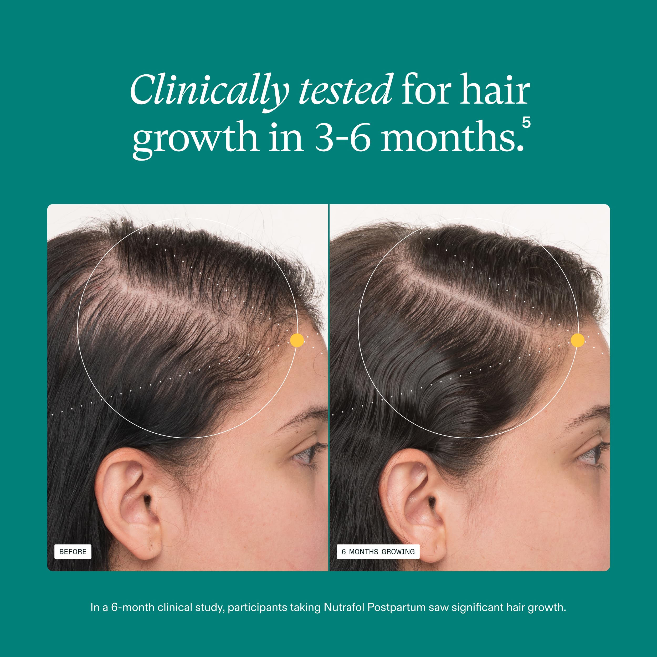 Nutrafol Postpartum Hair Growth Supplements, Clinically Tested for Visibly Thicker Hair and Less Shedding, Breastfeeding-friendly