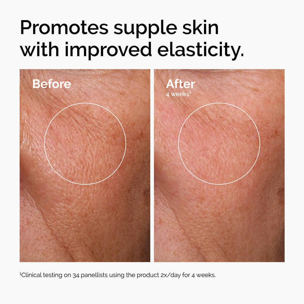 Buy now The Ordinary Serum Favorites Set â€“ Hyaluronic Acid 2% + B5, Niacinamide 10% + Zinc 1%, Caffeine Solution 5% â€“ Eye and Face Serums for Hydrating, Brightening & Pore-Minimizing Skin Care at indiglob india