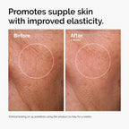 Buy now The Ordinary Serum Favorites Set â€“ Hyaluronic Acid 2% + B5, Niacinamide 10% + Zinc 1%, Caffeine Solution 5% â€“ Eye and Face Serums for Hydrating, Brightening & Pore-Minimizing Skin Care at indiglob india