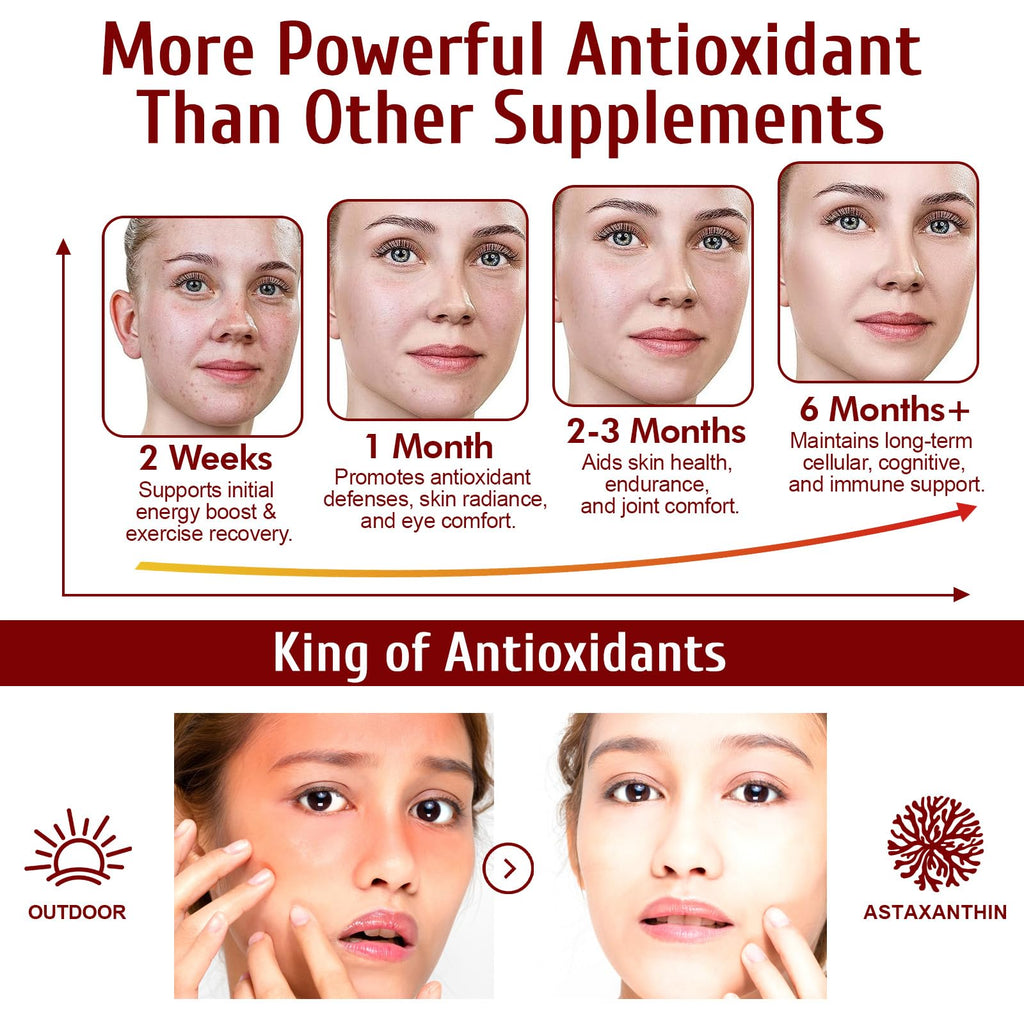 Astaxanthin 12mg, 120 Softgels, 4 Month Supply, Premium Astaxanthin Antioxidant Supplements with Antioxidant Activity, Supports Eye, Immune, Joint, Skin Health, Internal Circulation