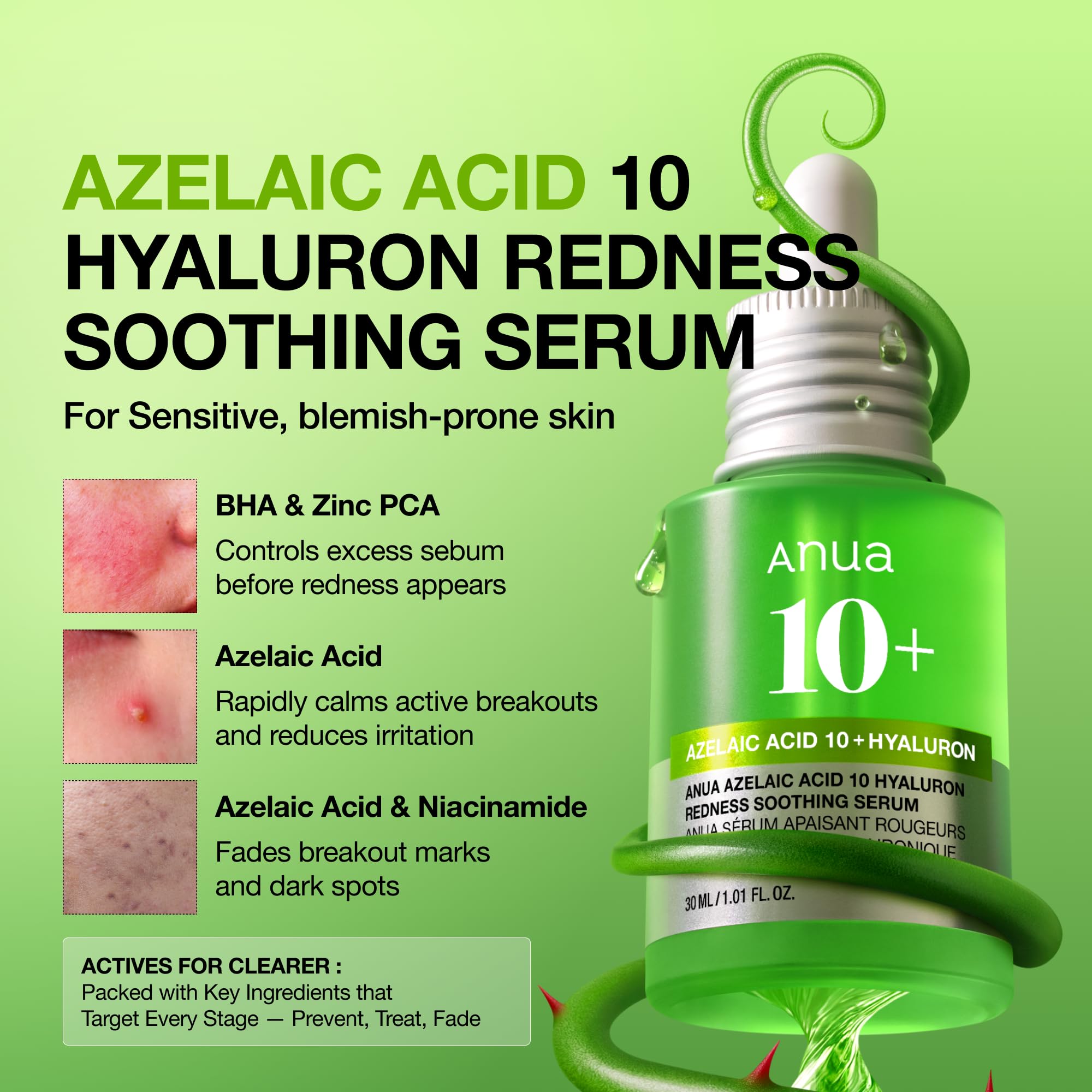 Anua Azelaic Acid 10 Hyaluron Redness Soothing Serum, 1.01 fl oz | Facial Serum for Blemish-Prone & Oily-Prone Skin, Lightweight & Hydrating Blemish Care, Hyaluronic Acid, Korean Skincare