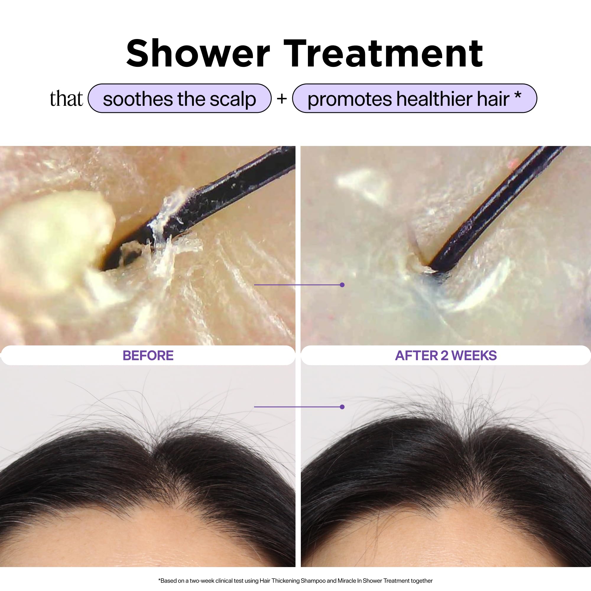 Dr. Groot Miracle in Shower Moisturizing Treatment for Hair Loss, Korean Hair Care Rinse, Rosemary Oil for Smooth, Healthier-Looking Hair in 5 Seconds, Scalp Revitalizing Solution