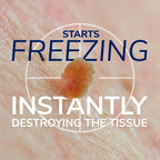 Dr. Scholl's Freeze Away Skin Tag Remover, Skin Tag Removal Kit, 8 Count