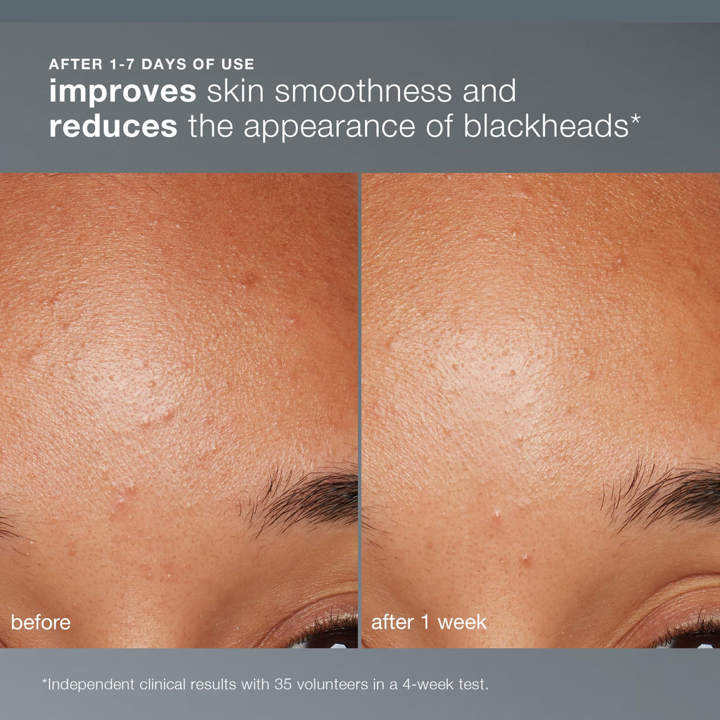 Dermalogica Daily Microfoliant, Brightening Face Exfoliator Powder | Brightens and Smooths Dull, Uneven Skin, Rice Powder Exfoliator with Papaya Enzyme, Salicylic Acid, and Rice Bran