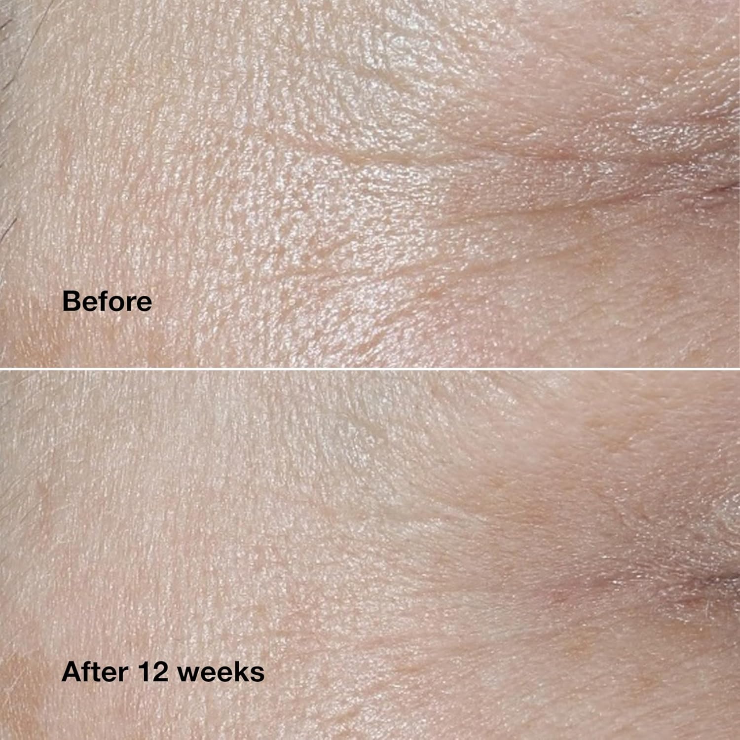 Buy now Clinique Smart Clinical Repair Wrinkle Correcting Anti Aging Face Cream With Hyaluronic Acid + Peptides For All Skin Types | Hydrating at indiglob india