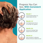 Minoxidil for Men Foam 5%, Unscented 3 Month Supply, Supports Hair Regrowth | Helps Restore Vertex Hair Loss & Thinning, Extra Strength 5% Minoxidil Foam For Men