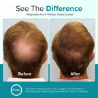 Minoxidil for Men Foam 5%, Unscented 3 Month Supply, Supports Hair Regrowth | Helps Restore Vertex Hair Loss & Thinning, Extra Strength 5% Minoxidil Foam For Men