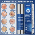 Rvlaim 100% Advanced Silicone Scar Gel for Old & New Scars,1.7oz/50ml