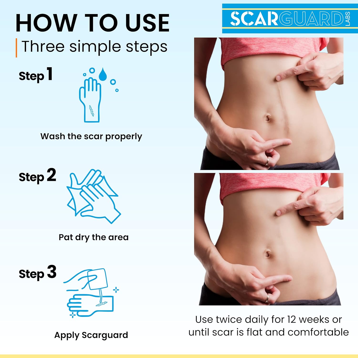 Buy now Scarguard - Invisible Brush-On Silicone Sheet with Vitamin E - Scar Removal for Keloids, Burn Scars, Surgery Scars, Stitches, Cuts - No Ugly Scar Sheets, Cream or Messy Scar Gel Needed at indiglob india