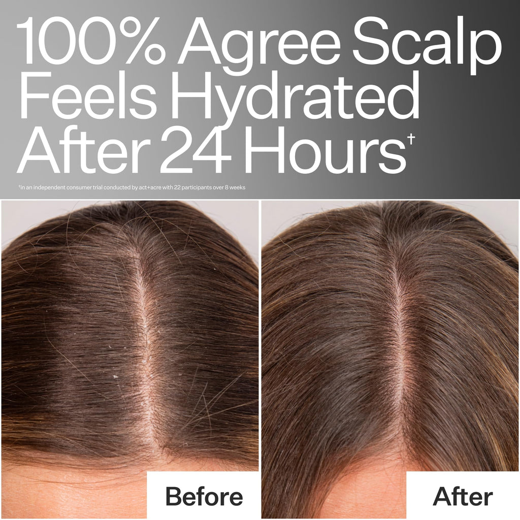 Act+ Acre, Daily Hydro Scalp Serum, Dry & Itchy Relief, 1 fl oz