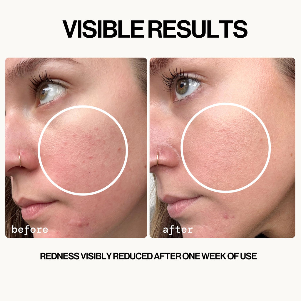 Pacifica Hypochlorous Acid Spray for Face and Skin; Barrier Defense Facial Mist | Soothe Redness, Acne, Eczema, Irritation | HOCl Non-Toxic Clean Formula Facial Cleanser Spray | Fragrance-Free, Vegan