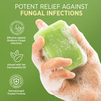 Roycederm Antifungal Bar Soap - Tea tree Oil Soap - Athlete’s Foot Treatment for Jock Itch & Ringworm - Medicated Antifungal Soap with Clotrimazole 1% - Tea Tree Oil Scent, 1 Pack