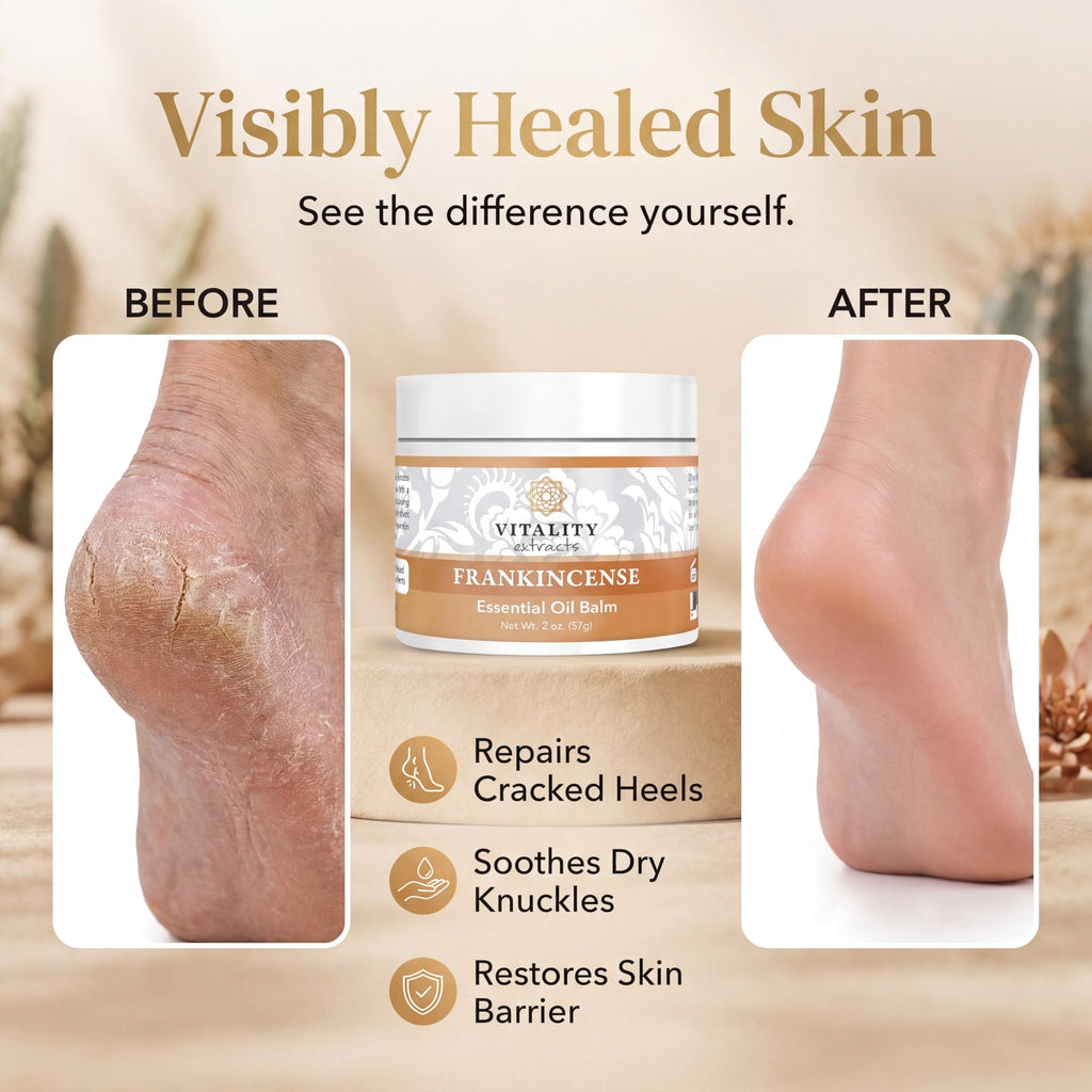 Vitality Extracts Frankincense Essential Oil Balm (2oz) – Boswellia Serrata, Beeswax & Vitamin E, Deep Moisturizing Skin Balm for Dry, Cracked Skin, Soothing & Nourishing for All Skin Types