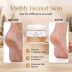 Vitality Extracts Frankincense Essential Oil Balm (2oz) – Boswellia Serrata, Beeswax & Vitamin E, Deep Moisturizing Skin Balm for Dry, Cracked Skin, Soothing & Nourishing for All Skin Types