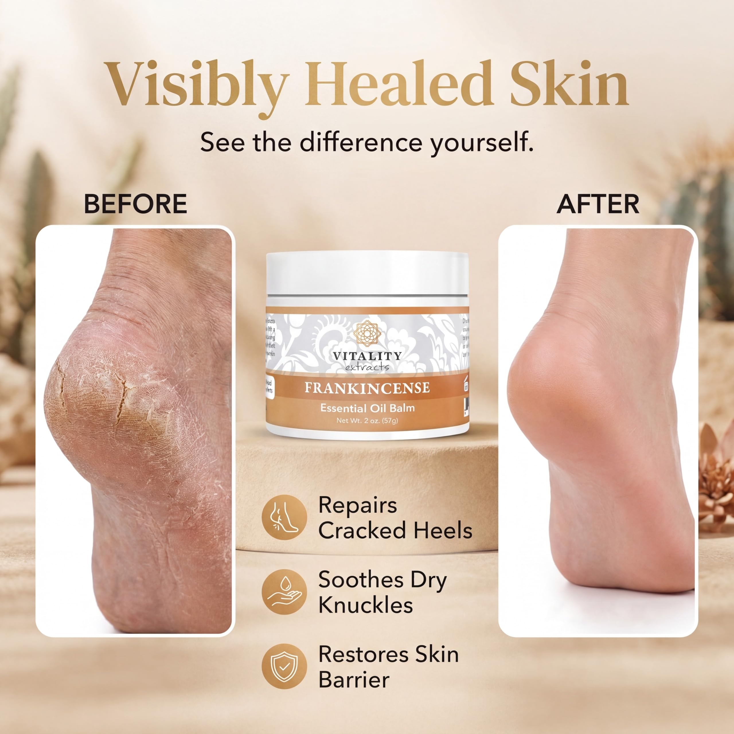 Vitality Extracts Frankincense Essential Oil Balm (2oz) – Boswellia Serrata, Beeswax & Vitamin E, Deep Moisturizing Skin Balm for Dry, Cracked Skin, Soothing & Nourishing for All Skin Types