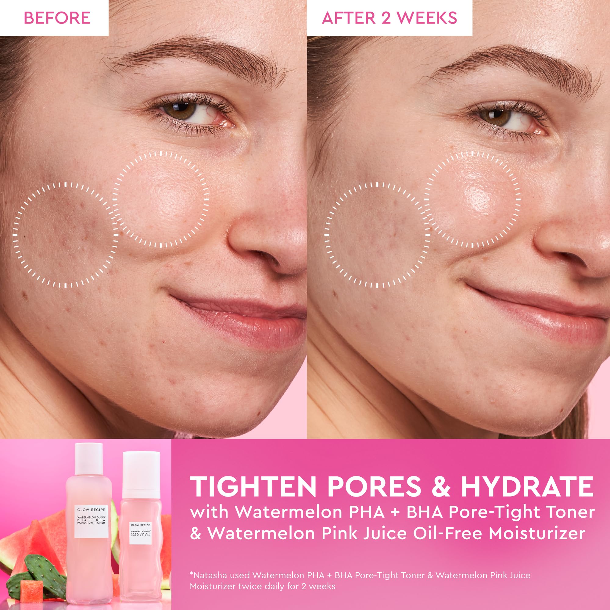 Glow Recipe PHA + BHA Face Toner, Korean Exfoliating Toner for Pores, Gentle Chemical Exfoliant + Hydrating Toner, Watermelon, Cactus Water + Glycerin (150ml)