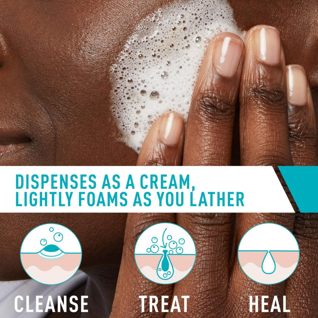 CeraVe Foaming Acne Cream Cleanser, Face Wash with 4% Benzoyl Peroxide, 5oz | Skin Care, Hyaluronic Acid, Niacinamide, Facial Cleanser, Acne Treatment For Face, Face Care, Gentle Cleanser, Ceramides