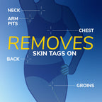 Dr. Scholl's Freeze Away Skin Tag Remover, Skin Tag Removal Kit, 8 Count