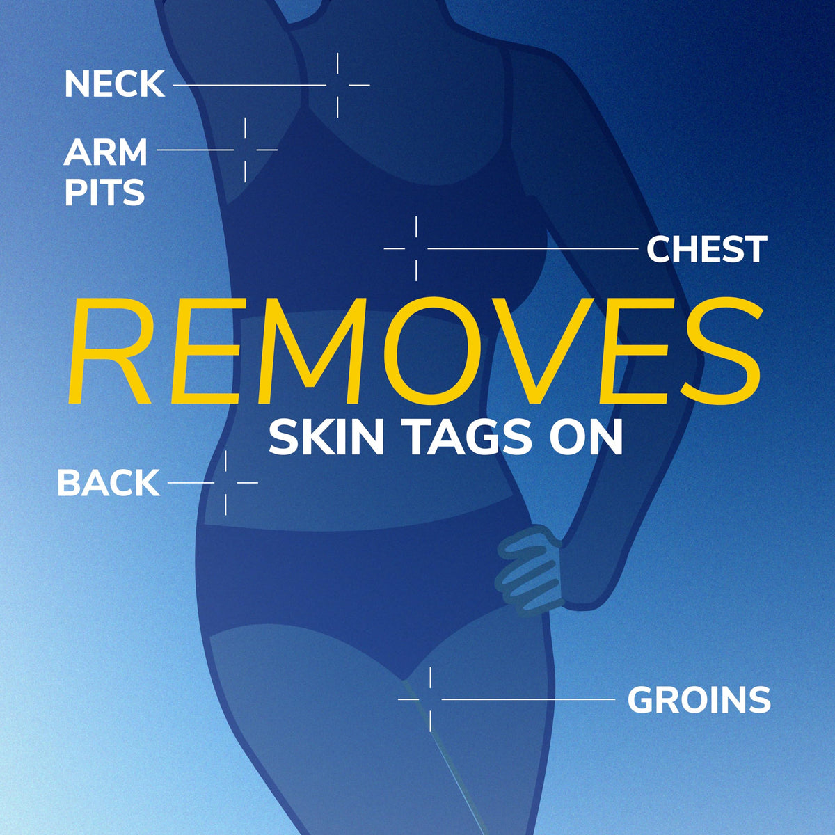 Dr. Scholl's Freeze Away Skin Tag Remover, Skin Tag Removal Kit, 8 Count