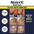 Buy now NONYX Fungal Nail Clarifying Gel | Clinically Proven for Discolored, Thick, Brittle, Yellow, Lifted, and other signs of Fungus-Damaged Toenails | 90% of Nails Improve | Over 8 million sold at indiglob india