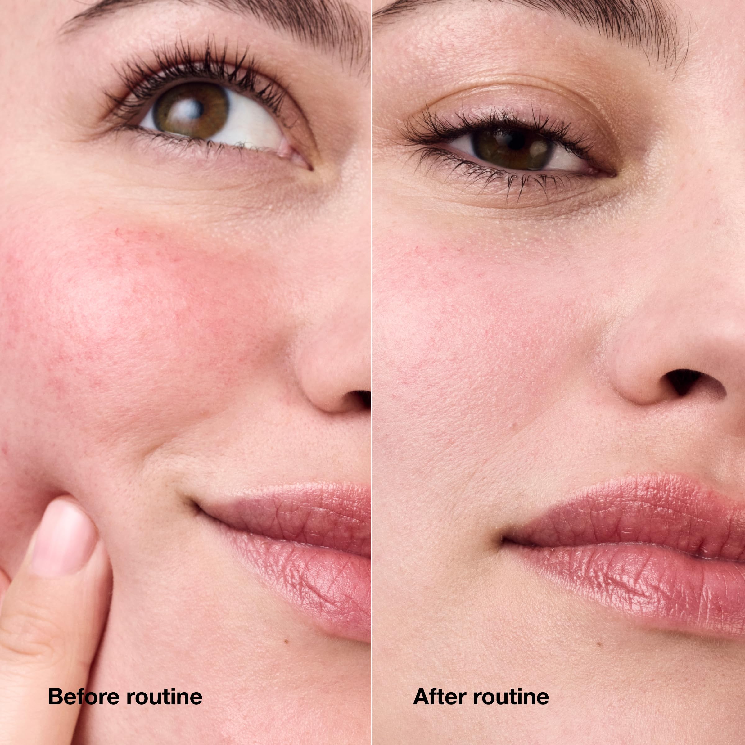 Buy now Clinique Redness Solutions Daily Relief Cream with Microbiome Technology, 1.7 Fl Oz at indiglob india
