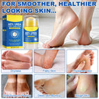 60% Urea Cream Stick plus 2% Salicylic Acid, Maximum Strength Urea Foot Cream Callus Remover for Dry Cracked Heels, Hands, Knees,Exfoliating Moisturizer, Dead Skin Remover Foot Balm 1.4oz (1pcs)