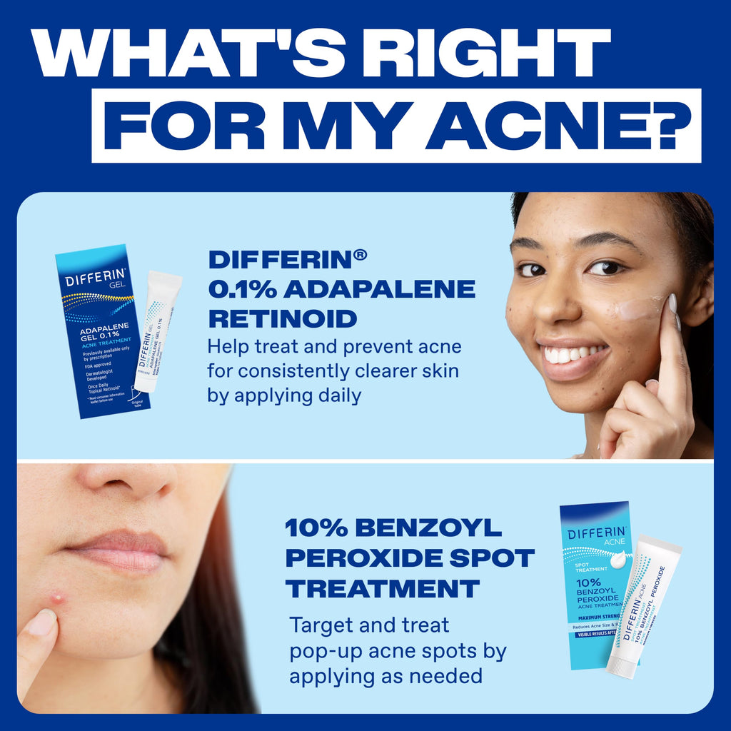 Differin Acne Spot Treatment, Max Strength, 10% Benzoyl Peroxide, 1 fl oz | Fast-Acting Pimple Treatment, Maximum Strength OTC Formula, Clears Acne Overnight, For Face, Dermatologist Brand