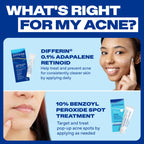 Differin Acne Spot Treatment, Max Strength, 10% Benzoyl Peroxide, 1 fl oz | Fast-Acting Pimple Treatment, Maximum Strength OTC Formula, Clears Acne Overnight, For Face, Dermatologist Brand